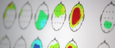 Gehirnaktivität beim Neurofeedback