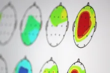 Gehirnaktivität beim Neurofeedback